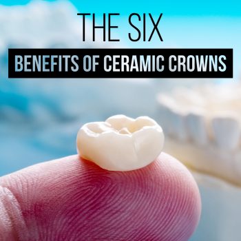 Savannah dentist, Dr. Comer at Christopher Comer DMD, explains the six benefits of ceramic crowns