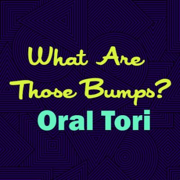 Savannah dentist Dr. Comer of Christopher Comer, DMD, explains oral tori—what they are, why they happen, and whether they are a cause for concern.