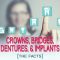 Crowns, Bridges, Dentures & Implants: The Facts (featured image)