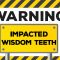 Warning Signs of Impacted Wisdom Teeth (featured image)